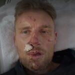 Freddie Flintoff reveals extent of injuries after Top Gear crash