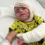 ‘She couldn’t move her mouth’: Baby suffers burns on more than half her body in Israeli airstrike