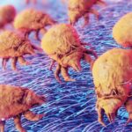 ‘Life-changing’ treatment could help thousands of people with severe dust mite allergy