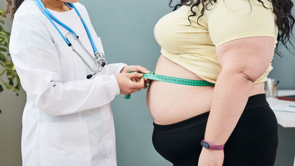 People being ‘overdiagnosed’ with obesity because BMI score not ‘nuanced’ enough, medics say