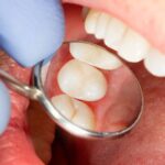 Extra 700,000 dentist appointments to be available in ‘dental deserts’